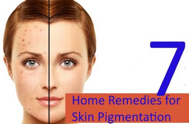Seven Wonder Home Remedies for Skin Pigmentation